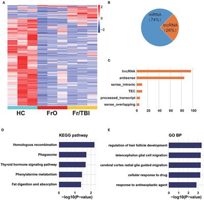 Long Non-coding RNAs in Traumatic Brain Injury Accelerated Fracture Healing